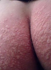 Top Pain photo 9 of 14