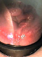 Top Pain photo 7 of 14