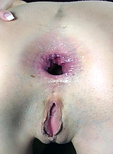 Dark Holes photo 2 of 10