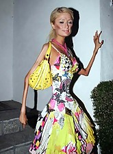 Skinny Beauties photo 3 of 5