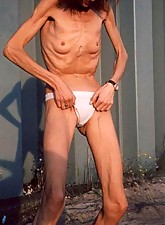 Skinny Beauties photo 1 of 5