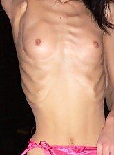 Skinny Beauties photo 3 of 5