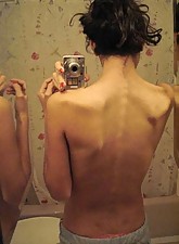 Skinny Beauties photo 1 of 5