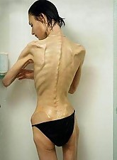 Skinny Beauties photo 1 of 5