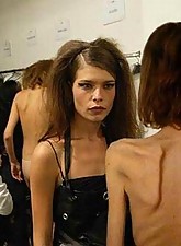 Skinny Beauties photo 1 of 4