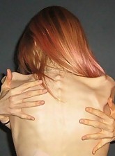 Skinny Beauties photo 3 of 4