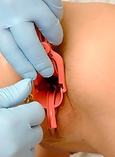 Medical Fetish photo 4 of 5