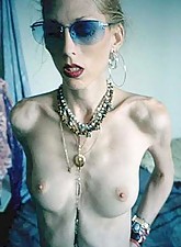 Skinny Girls photo 2 of 4