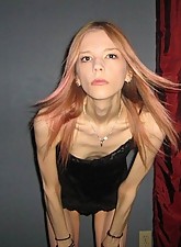 Skinny Girls photo 5 of 8