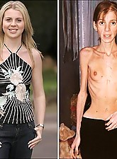 Skinny Girls photo 3 of 4