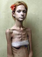 Skinny Girls photo 1 of 5