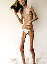 Skinny Girls photo 3 of 5