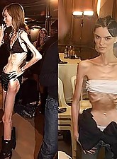 Skinny Girls photo 3 of 4