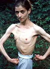 Skinny Girls photo 3 of 5