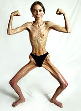 Skinny Girls photo 4 of 5