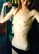 Skinny Girls photo 5 of 5