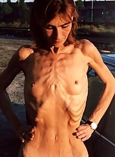 Skinny Girls photo 4 of 5