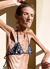 Skinny Girls photo 4 of 4
