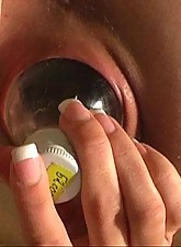 Incredible Anal Insertions photo 8 of 10