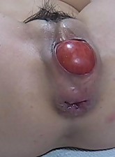 Incredible Anal Insertions photo 6 of 10