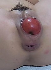 Incredible Anal Insertions photo 7 of 10