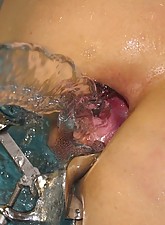 Incredible Anal Insertions photo 2 of 10