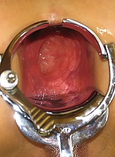 Incredible Anal Insertions photo 5 of 10