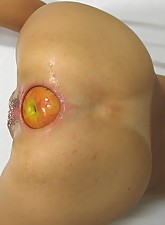 Incredible Anal Insertions photo 1 of 10