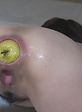 Incredible Anal Insertions photo 1 of 10
