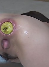 Incredible Anal Insertions photo 10 of 10