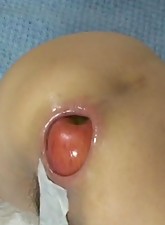 Incredible Anal Insertions photo 5 of 10