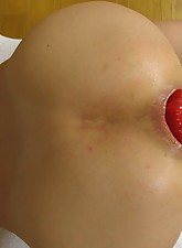 Incredible Anal Insertions photo 1 of 10