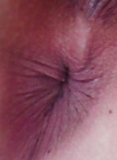 My Hot Ass photo 8 of 10