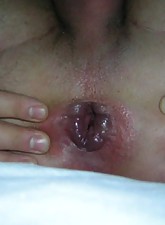 My Hot Ass photo 3 of 10