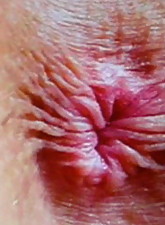 My Hot Ass photo 8 of 10